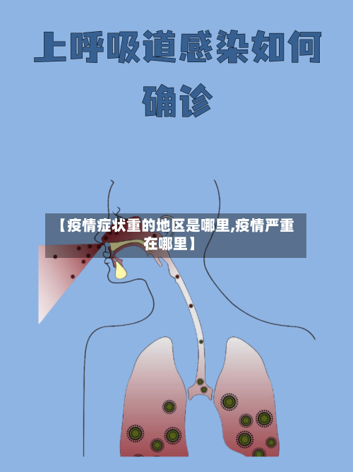 【疫情症状重的地区是哪里,疫情严重在哪里】-第2张图片